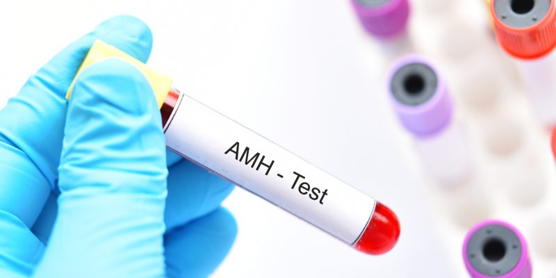 AMH Testi